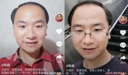 真好哥陆超视频,短视频背后的励志人生