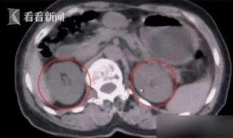 女生拉稀视频大全,女生拉稀视频大全集锦
