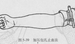 加压包扎止血法视频,关键时刻的急救技能解析