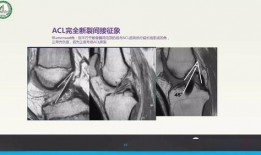 强忍拉韧带视频,揭秘强忍拉韧带健身法